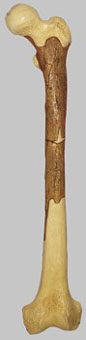 Femur of Homo Ergaster